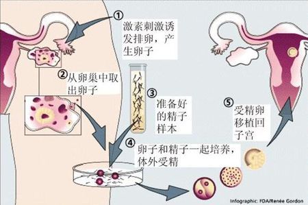 生殖内分泌专家